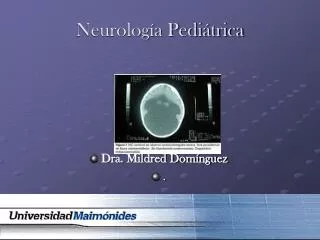 neurolog a pedi trica