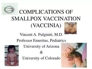 COMPLICATIONS OF SMALLPOX VACCINATION (VACCINIA)