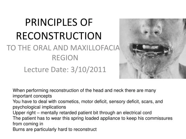 principles of reconstruction