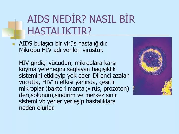 aids ned r nasil b r hastaliktir