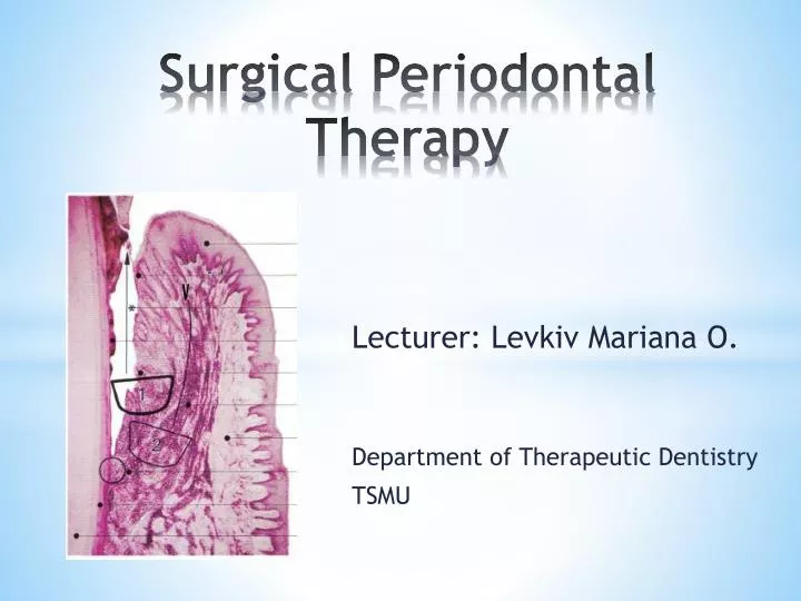 surgical periodontal therapy