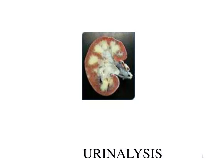 urinalysis