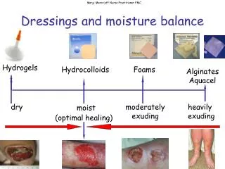 Dressings and moisture balance