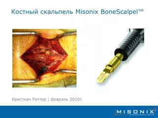 Костный скальпель Misonix BoneScalpel™