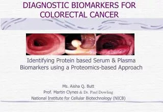 DIAGNOSTIC BIOMARKERS FOR COLORECTAL CANCER
