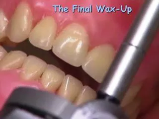 The Final Wax-Up