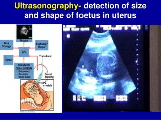 Ultrasonography- detection of size and shape of foetus in uterus