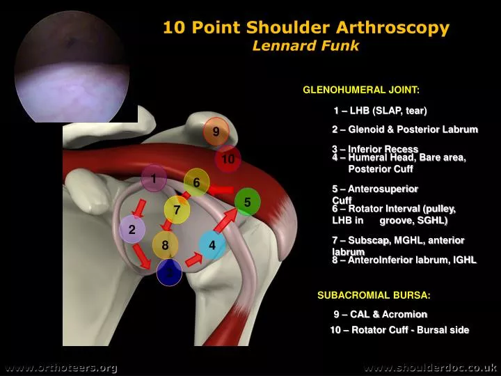 10 point shoulder arthroscopy lennard funk