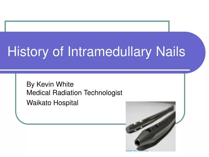 history of intramedullary nails