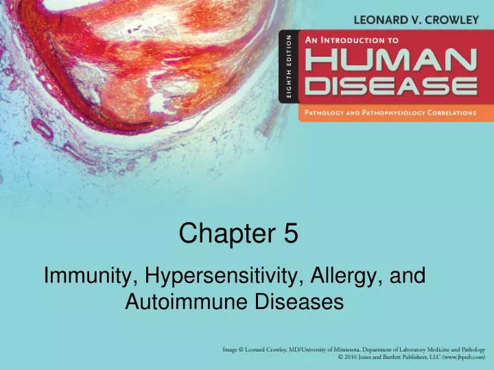 immunity hypersensitivity allergy and autoimmune diseases