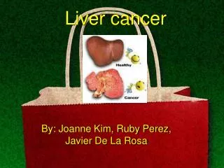 Liver cancer