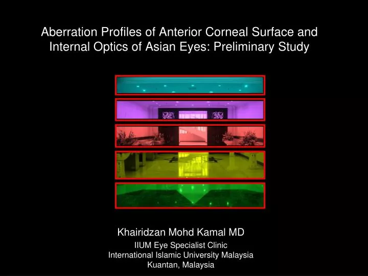 aberration profiles of anterior corneal surface and internal optics of asian eyes preliminary study