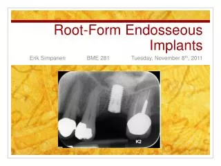 Root-Form Endosseous Implants
