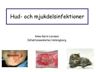 hud och mjukdelsinfektioner