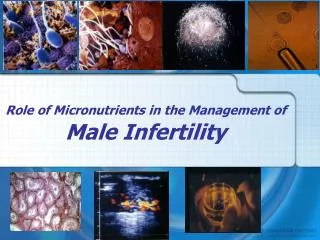 Role of Micronutrients in the Management of Male Infertility