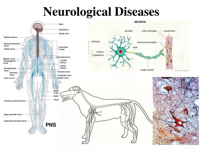 neurological diseases