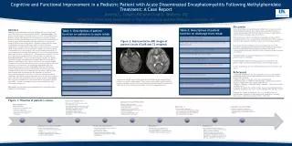 Cognitive and Functional Improvement in a Pediatric Patient with Acute Disseminated Encephalomyelitis Following Methylph