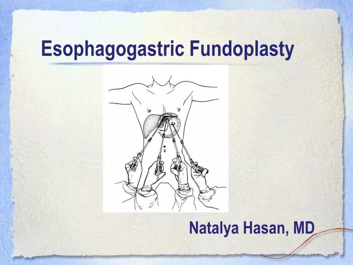 esophagogastric fundoplasty