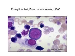 Proerythroblast, Bone marrow smear, x1000