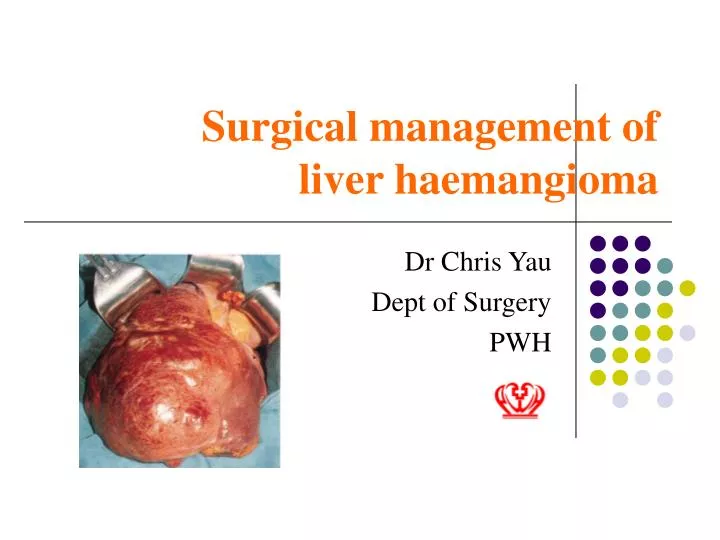 surgical management of liver haemangioma