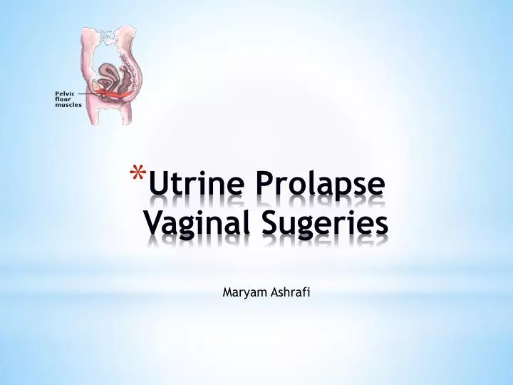 utrine prolapse vaginal sugeries