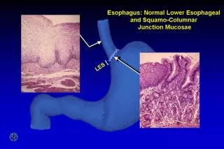 Esophagus: Normal Lower Esophageal and Squamo-columnar Junction Mucosae