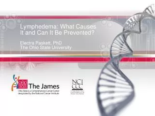 Lymphedema: What Causes It and Can It Be Prevented?
