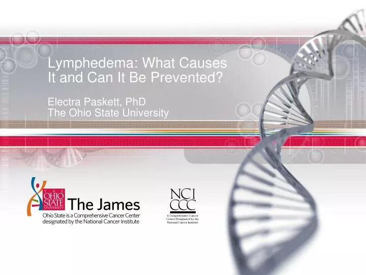 lymphedema what causes it and can it be prevented