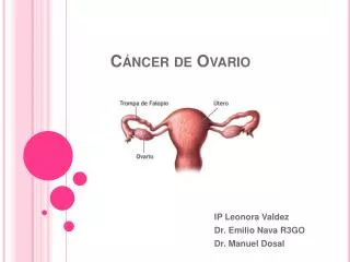 Cáncer de Ovario