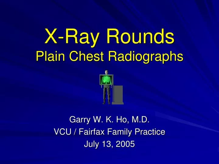 x ray rounds plain chest radiographs