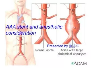 AAA stent and anesthetic consideration