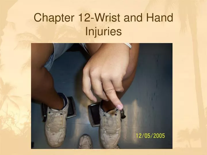 chapter 12 wrist and hand injuries