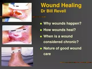 Wound Healing Dr Bill Revell