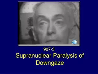 Supranuclear Paralysis of Downgaze