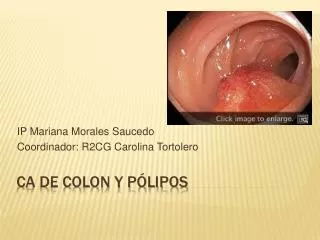 ip mariana morales saucedo coordinador r2cg carolina tortolero