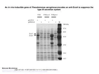 An in vivo inducible gene of Pseudomonas aeruginosa encodes an anti?ExsA to suppress the type III secretion system