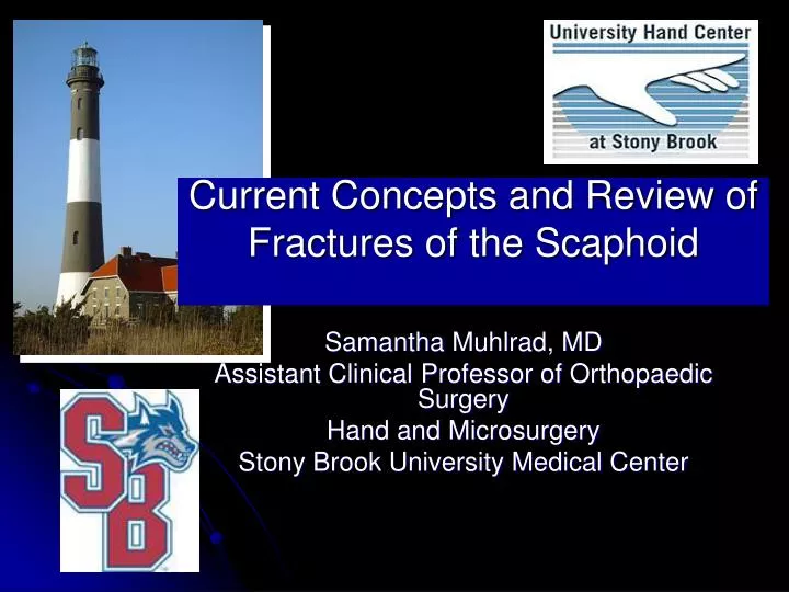 current concepts and review of fractures of the scaphoid