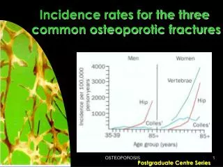 Incidence rates for the three common osteoporotic fractures