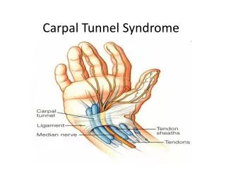 Carpal Tunnel Syndrome