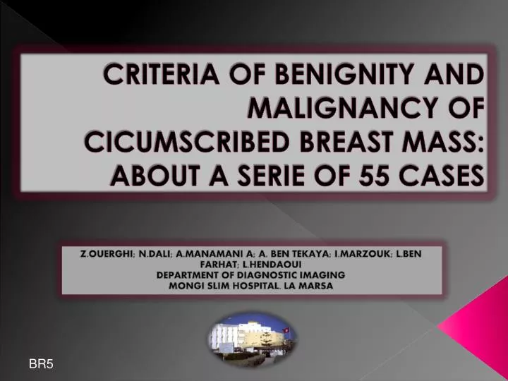 criteria of benignity and malignancy of cicumscribed breast mass about a serie of 55 cases