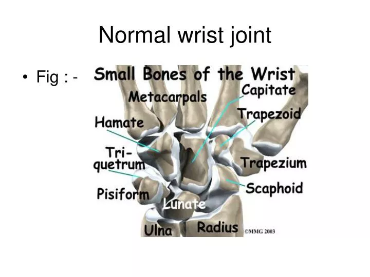 normal wrist joint