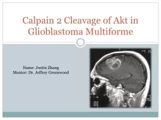 Calpain 2 Cleavage of Akt in Glioblastoma Multiforme