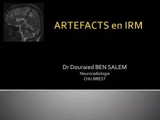 dr douraied ben salem neuroradiologie chu brest