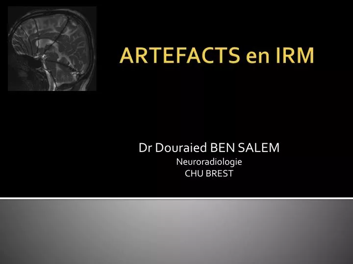 dr douraied ben salem neuroradiologie chu brest