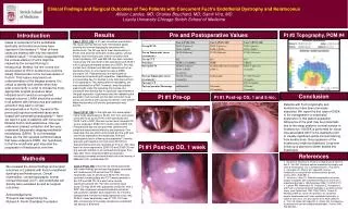 Clinical Findings and Surgical Outcomes of Two Patients with Concurrent Fuch’s Endothelial Dystrophy and Keratoconus