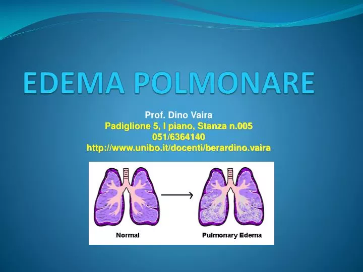 edema polmonare