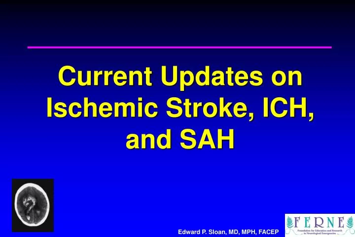 current updates on ischemic stroke ich and sah