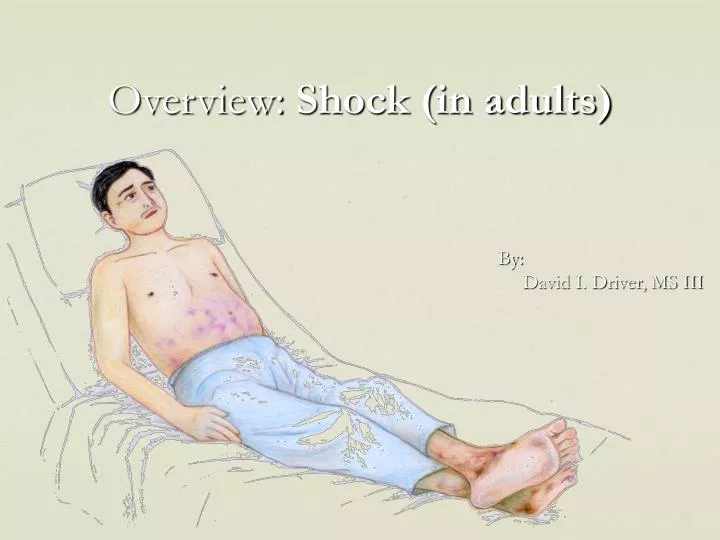 overview shock in adults