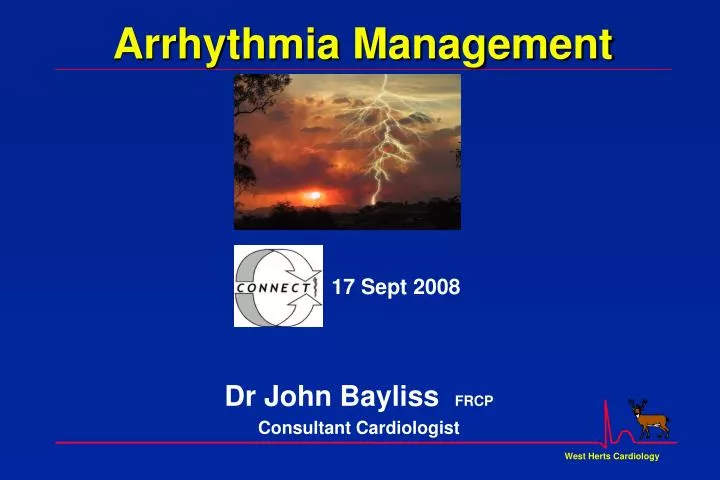 arrhythmia management