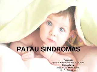 patau sindromas